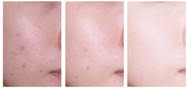 网红同款助眠喷雾来了!轻松一喷睡到天亮(图23)