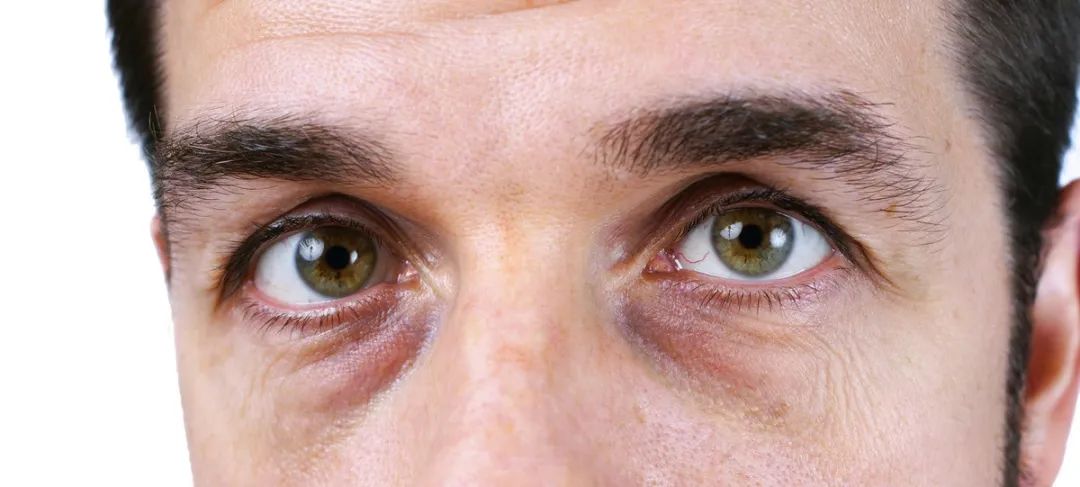 网红同款助眠喷雾来了!轻松一喷睡到天亮(图5)