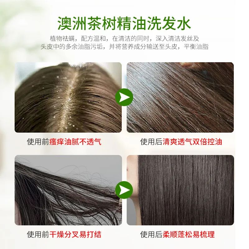 和螨虫说拜拜!持续断货的澳洲茶树洗护系列全新升级!抢先体验(图22)