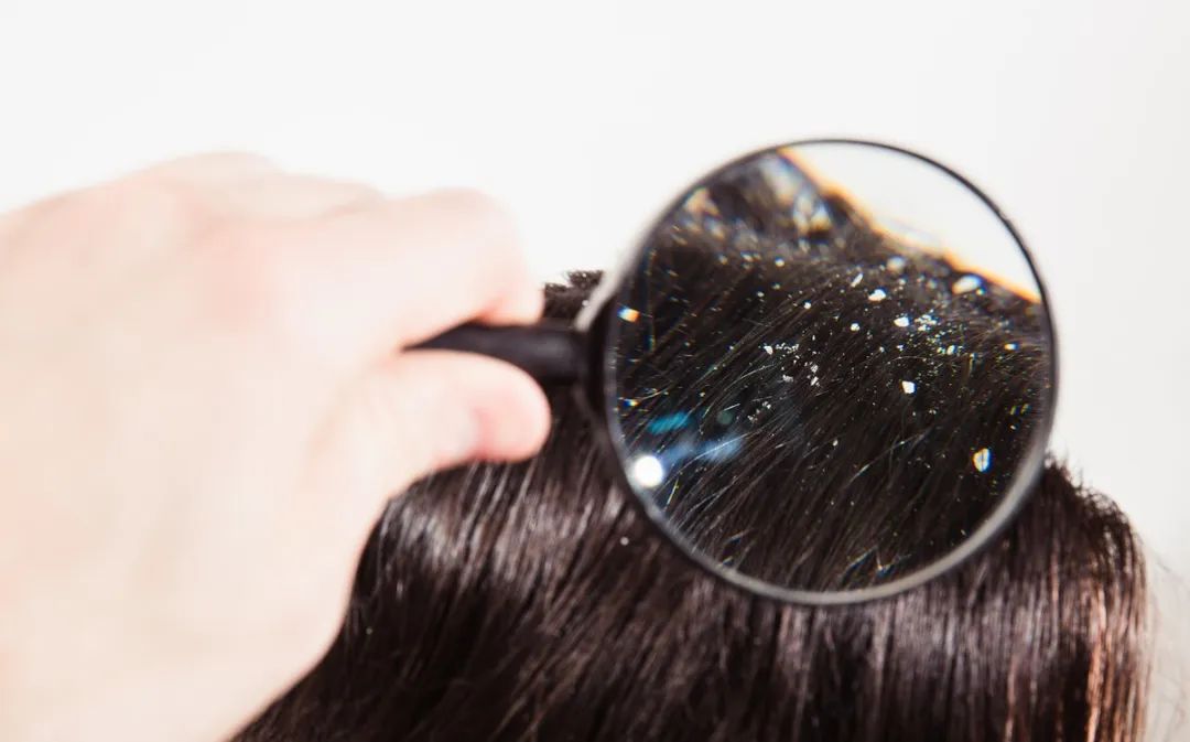 和螨虫说拜拜!持续断货的澳洲茶树洗护系列全新升级!抢先体验(图9)