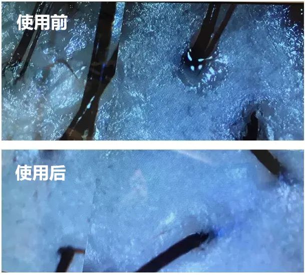 亚麻籽究竟有多神奇?用它,头发蓬松不出油,关键是拯救秃头!(图15)