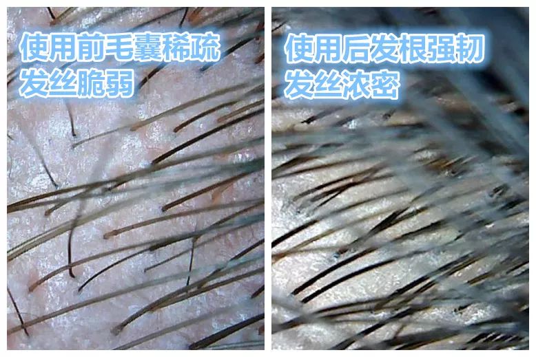 亚麻籽究竟有多神奇?用它,头发蓬松不出油,关键是拯救秃头!(图18)