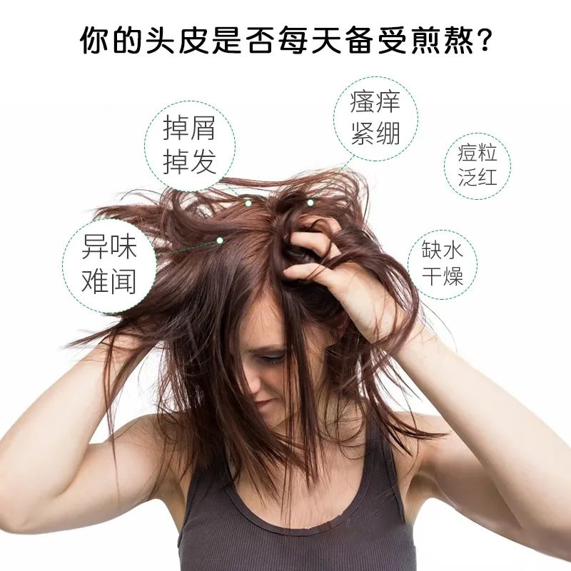 澳洲茶树精油洗发水 重拾自信,从头做起。(图1) 图片