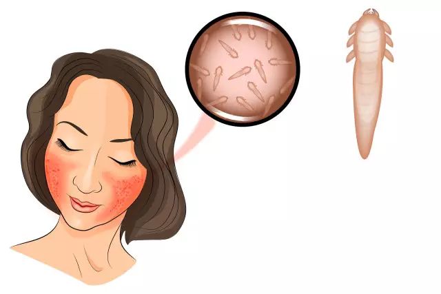 听说皮肤有螨虫?别怕,性价比巨高的神仙洗面奶,带你创造牛奶嫩肌!(图15) 图片