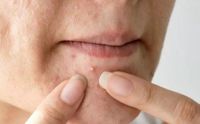 听说皮肤有螨虫?别怕,性价比巨高的神仙洗面奶,带你创造牛奶嫩肌!(图3) 图片