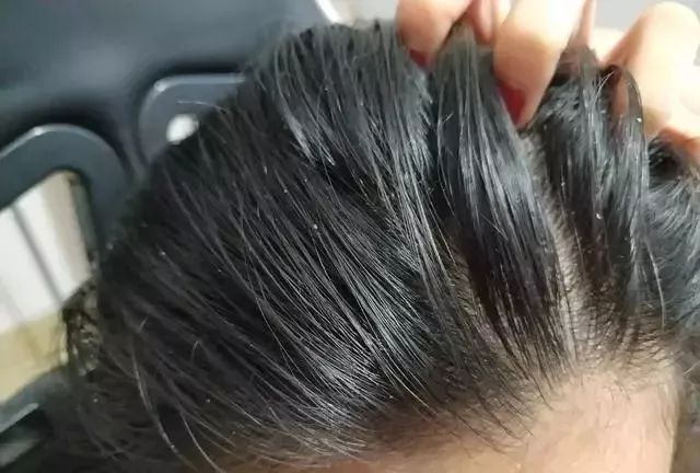 澳洲茶树精油洗发水,除螨、去油、味道芳香(图2) 图片