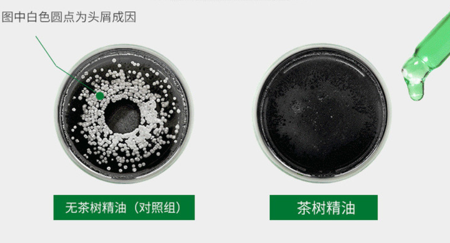 “油头克星”澳洲茶树精油——控油、除螨、去屑一瓶全搞定!(图8) 图片