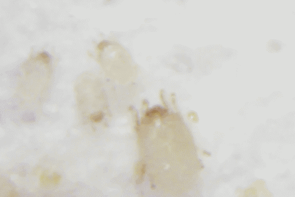 澳洲茶树精油沐浴露除螨祛痘,守候肌肤健康(图3) 图片